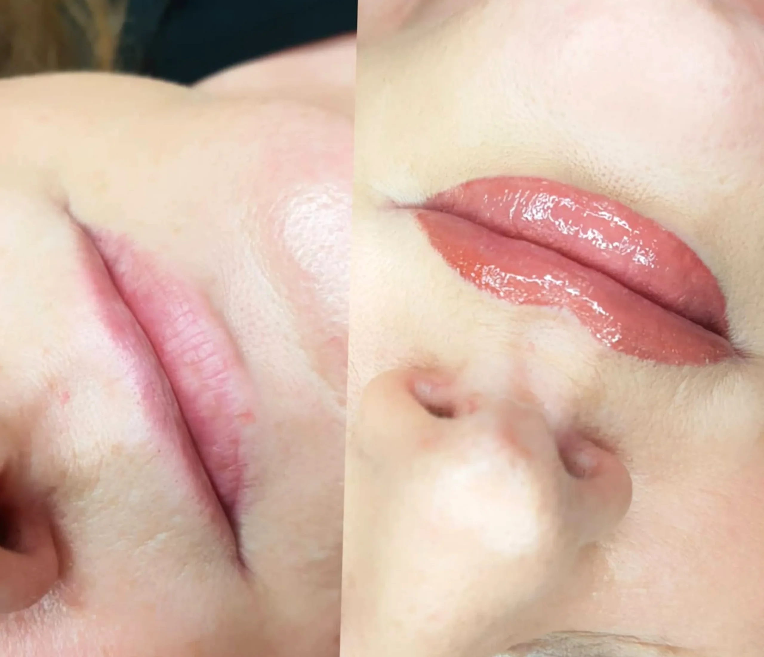lip blush cold sore prevention