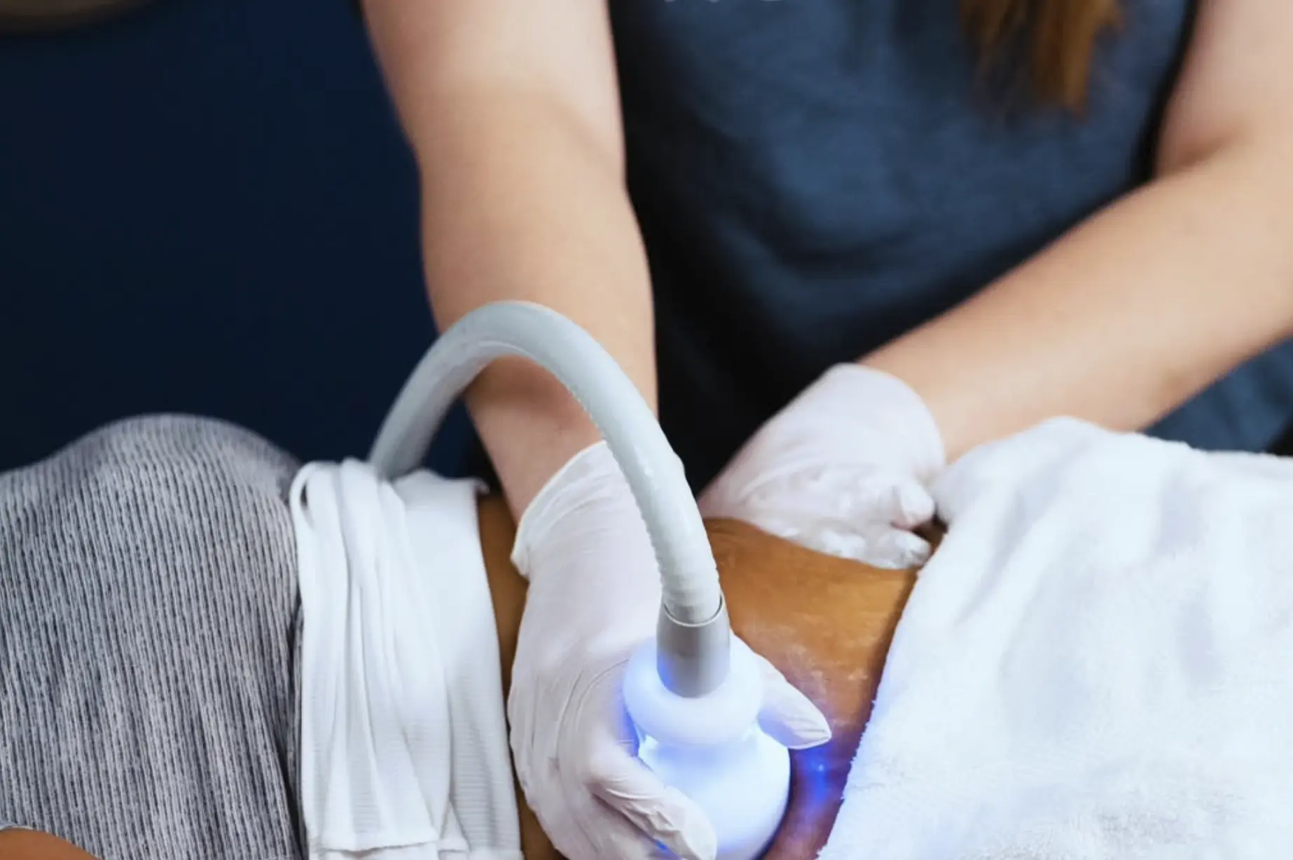 cryoskin benefits